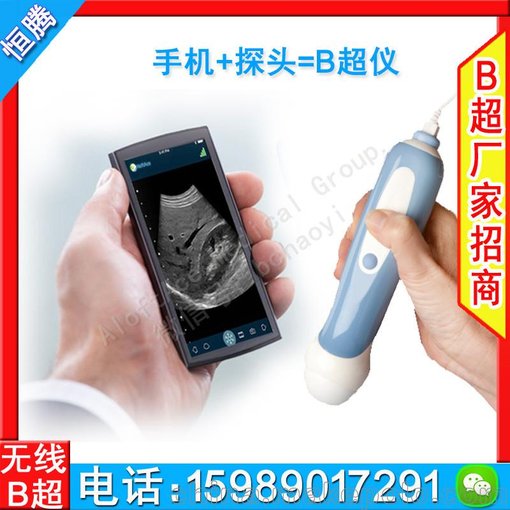 無(wú)線探頭彩超機(jī)廣州推車(chē)式彩超廠家直銷(xiāo) 恒騰進(jìn)口b超圖片