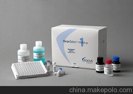 人鐵-過氧化物岐化酶(Fe-SOD)elisa盒說明書圖片