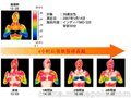 西班牙茵迪巴仪器 indiba热能射频设备减脂养护