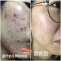 厂家贴牌生产OEMODM蓝铜肽修护精华液一天用几次